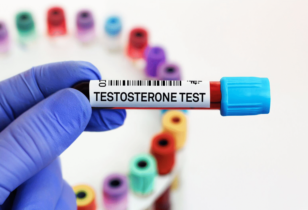 Low Testosterone Test